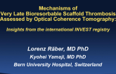 TCT 10: Mechanisms of Very Late Bioresorbable Scaffold Thrombosis Assessed by Optical Coherence Tomography - Insights From the International INVEST Registry