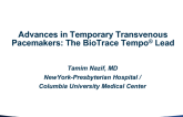 Advances in Temporary Transvenous Pacemakers: The BioTrace Active Fixation Lead