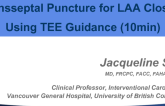 Trans-septal Puncture for LAA Closure Using TEE Guidance