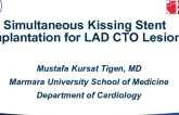 Simultaneous Kissing Stent Implantation for LAD CTO Lesion