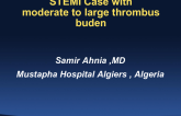 Case Presentation: STEMI With Moderate to Large Thrombus Burden