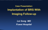 Case Presentation: Implantation of BRS With Imaging Follow-up