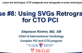 Case #8: Using SVGs Retrograde for CTO PCI (With Discussion)