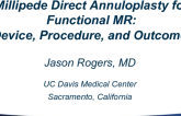 Millipede Direct Annuloplasty for Functional MR: Device, Procedure, and Outcomes