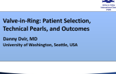 Valve-in-Ring: Patient Selection, Technical Pearls, and Outcomes