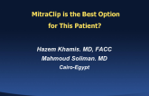 Case Presentation: Moderate-Severe Degenerative Mitral Regurgitation in a 70-Year-Old Female With a Moderately Dilated LV and LVEF of 40%