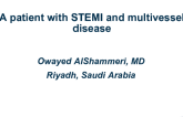 Case Presentation: A Patient With STEMI and Multivessel Disease