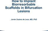 Case #2: How to Implant Bioresorbable Scaffolds in Bifurcation Lesions (With Discussion)