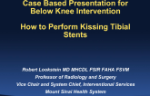 Case #8: How to Perform Bifurcation Stenting in the Tibial Arteries (With Discussion)