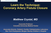 Case #7: Coronary Artery Fistula Closure (With Discussion)