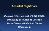 Case #2: A Radial Nightmare (With Discussion)