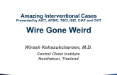 Case #2: Wire Gone Weird