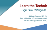 Case #2: High Tibial Retrograde Access (With Discussion)