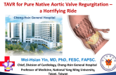 Case #4: TAVR for Pure Native Aortic Regurgitation - A Horrifying Ride