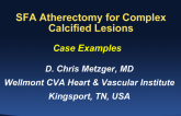 SFA Atherectomy for Complex Calcified Lesions: Case Examples and Data