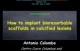 Case #5: How to Implant Bioresorbable Scaffolds in Calcified Lesions (With Discussion)