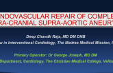 Endovascular Repair of Complex Extracranial Supra-aortic Aneurysms: 2 Case Reports