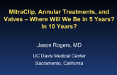 Mitral Valve Interventions: MitraClip, Annular Treatments, and Valves – Where Will We Be in 5 Years? In 10 Years?