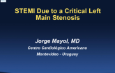 Case #3: STEMI Due to a Critical Left Main Stenosis