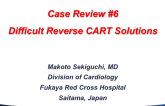 Case #6: Difficult Reverse CART Solutions (With Discussion)