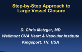 Step-by-step Approach for Large Vessel Closure