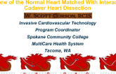In-depth Cardiac Structure and Hemodynamic Review Matched With Interactive Cadaver Heart Dissection