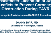 Case #1: Transcatheter Laceration of Aortic Leaflets to Prevent Coronary Obstruction During Transcatheter Aortic Valve Implantation: Concept to First-in-Human BASILICA Procedures (With Discussion)