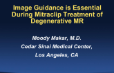 Case #1: Image Guidance Is Essential During MitraClip Treatment of Degenerative MR (With Discussion)
