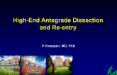 Case #4 High-end Antegrade Dissection and Reentry (With Discussion)