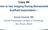 Case #4: How to Use Imaging During Bioresorbable Scaffold Implantation (With Discussion)