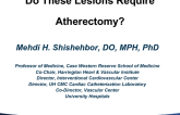 Do These Lesions Require Atherectomy? Five Rapid Fire Cases Discussed