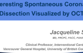 Case #5: An Interesting Spontaneous Coronary Dissection Visualized by OCT (With Discussion)