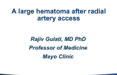 CASE #6: A Large Hematoma After Radial Artery Access (With Discussion)