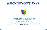 Minimally Invasive Transfemoral TAVR