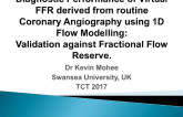 Diagnostic Performance of Virtual FFR Derived From Routine Coronary Angiography Using 1D Flow Modelling: Validation Against Conventional FFR