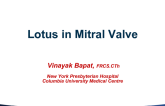 Case #3: Transapical Mitral ViV With Lotus (With Discussion)