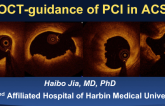 Case Presentation: OCT-Guidance of PCI in ACS