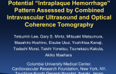 TCT 48: Potential “Intraplaque Hemorrhage” Pattern Assessed by Combined Intravascular Ultrasound and Optical Coherence Tomography