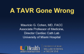 Case #3: A TAVR Gone Wrong (With Discussion)