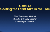 Case #2: Selecting the Stent Size in the LMCA Bifurcation