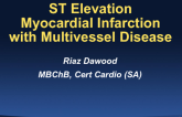 South Africa Presents a Case: STEMI With Multivessel Disease