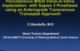 Percutaneous Mitral Valve-in Valve Implantation With SAPIEN 3 Prosthesis Using an Anterograde Transvenous Transseptal Approach