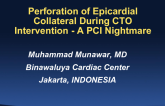 Complex Case #8: Perforation of Epicardial Collateral During CTO Intervention - A PCI Nightmare