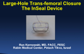 Large-hole Trans-femoral Closure II: The Inseal Device