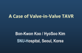 Korea Presents: A Case of Valve-in-Valve TAVR