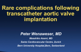 Switzerland Presents: Cases Demonstrating TAVR Limitations