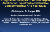 TCT 103: Long-Term Outcomes of Alcohol Septal Ablation for Hypertrophic Obstructive Cardiomyopathy: A 16 Year Study