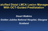 Case #10: Calcified Distal LMCA Lesion Managed With OCT-Guided Predilatation