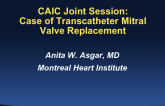 Canada Presents: Mitral, Tricuspid, and Aortic Valve Transcatheter Cases