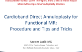 Cardioband Direct Annuloplasty for Functional MR: Procedure and Tips and Tricks